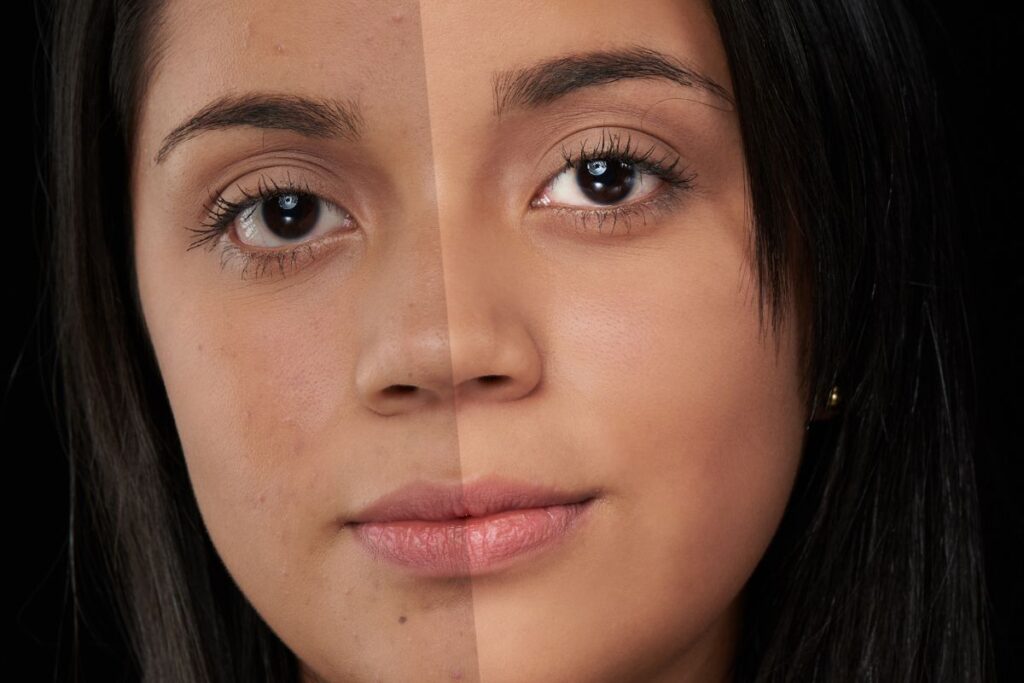 Como Corrigir Imperfeições em Fotos Usando o Photoshop